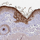 Immunohistochemical staining of human skin shows strong cytoplasmic and nuclear positivity in keratinocytes.