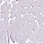 Immunohistochemical staining of human skeletal muscle shows no positivity in myocytes.