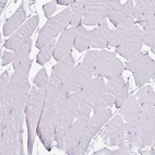 Immunohistochemical staining of human skeletal muscle shows no positivity in myocytes.
