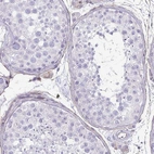 Immunohistochemical staining of human testis shows no positivity in cells in seminiferous ducts.