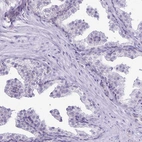 Immunohistochemical staining of human prostate shows no positivity in glandular cells.