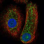 Immunofluorescent staining of human cell line hTCEpi shows localization to nucleus, cytosol & mitochondria.