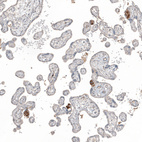 Anti-FN1 Antibody