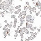 Immunohistochemical staining of human placenta shows moderate positivity in extracellular matrix in trophoblastic cells.
