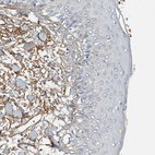 Anti-FN1 Antibody