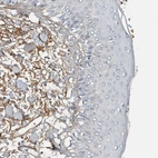 Immunohistochemical staining of human skin shows moderate positivity in dermis.