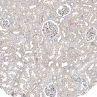 Immunohistochemical staining of human kidney shows weak positivity in plasma.