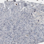 Immunohistochemical staining of human pancreas shows no positivity in exocrine glandular cells as expected.