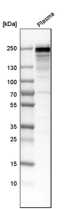 Western blot analysis in human plasma.