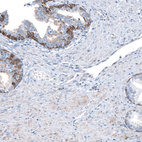 Immunohistochemical staining of human prostate shows moderate membranous and cytoplasmic positivity in glandular cells.