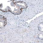 Immunohistochemical staining of human prostate shows moderate membranous and cytoplasmic positivity in glandular cells.