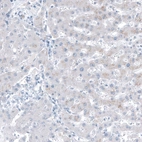 Immunohistochemical staining of human liver shows negative to very weak cytoplasmic positivity in hepatocytes.