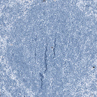 Immunohistochemical staining of human lymph node shows no positivity in lymphoid cells as expected.