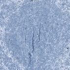 Immunohistochemical staining of human lymph node shows no positivity in lymphoid cells as expected.