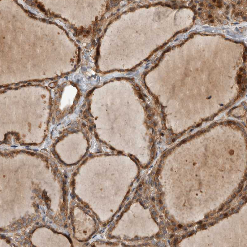 Anti-TUBD1 Antibody