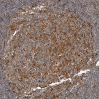 Immunohistochemical staining of human lymph node shows strong cytoplasmic positivity in germinal center cells.