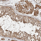 Immunohistochemical staining of human testis shows strong cytoplasmic positivity in Leydig cells and cells in seminiferous ducts.