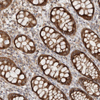 Immunohistochemical staining of human rectum show strong cytoplasmic positivity in glandular cells.