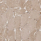 Immunohistochemical staining of human skeletal muscle shows weak cytoplasmic positivity in myocytes.