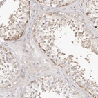 Immunohistochemical staining of human testis shows weak to moderate cytoplasmic positivity in cells in seminiferous ducts.