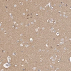 Immunohistochemical staining of human cerebral cortex shows moderate positivity in neuropil.