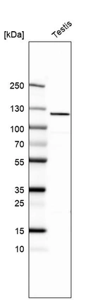 Western blot analysis in human testis tissue.