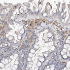 Anti-SIGLEC10 Antibody