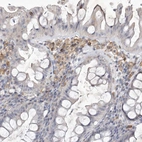 Immunohistochemical staining of human colon shows weak to moderate cytoplasmic / membranous positivity in lymphoid cells.