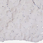 Immunohistochemical staining of human skeletal muscle shows no positivity in myocytes as expected.