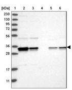 Lane 1: Marker [kDa] 230, 130, 95, 72, 56, 36, 28, 17, 11_br/_Lane 2: Human cell line RT-4_br/_Lane 3: Human cell line U-251MG sp_br/_Lane 4: Human plasma (IgG/HSA depleted)_br/_Lane 5: Human liver tissue_br/_Lane 6: Human tonsil tissue