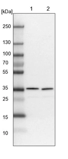 Lane 1: NIH-3T3 cell lysate (Mouse embryonic fibroblast cells)_br/_Lane 2: NBT-II cell lysate (Rat Wistar bladder tumour cells)