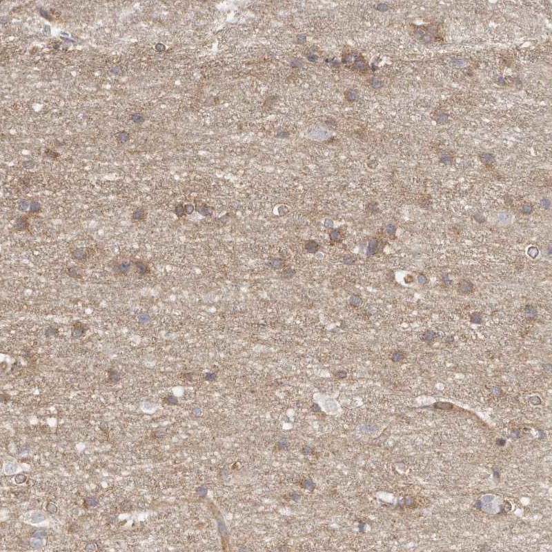 Anti-MTERF4 Antibody