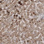 Anti-SCP2 Antibody