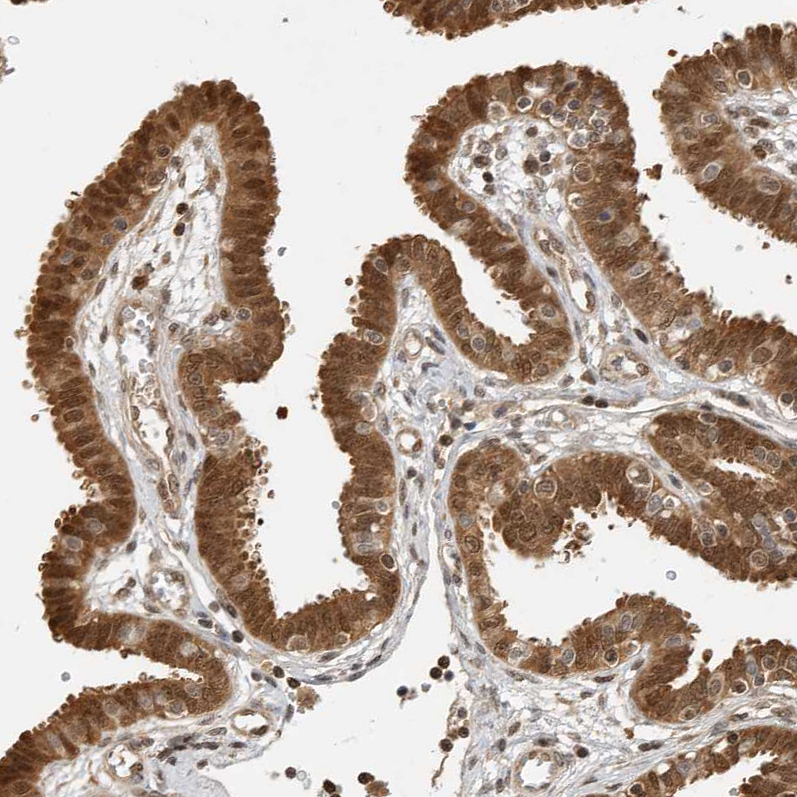 Anti-ADPRHL2 Antibody