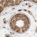 Immunohistochemical staining of human testis shows strong cytoplasmic and nuclear positivity in cells in seminiferous ducts.