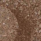 Immunohistochemical staining of human tonsil shows strong cytoplasmic and membranous positivity in non-germinal center cells.