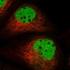 Immunofluorescent staining of human cell line A-431 shows localization to nucleoplasm.