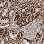Anti-C1orf109 Antibody