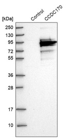 Anti-CCDC170 Antibody