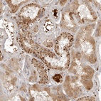 Anti-KLHL38 Antibody