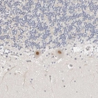 Anti-TSEN2 Antibody