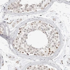 Immunohistochemical staining of human testis shows strong nuclear positivity in spermatogonia.