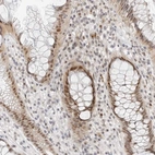 Immunohistochemical staining of human rectum shows moderate nuclear positivity in glandular cells.