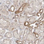 Anti-MTFR1L Antibody