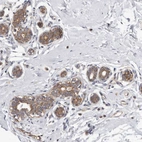 Immunohistochemical staining of human breast shows moderate to strong cytoplasmic positivity in glandular cells.