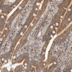Immunohistochemical staining of human gastrointestinal shows moderate to strong cytoplasmic positivity in glandular cells.