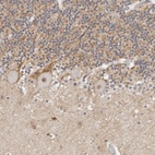 Anti-TSEN2 Antibody