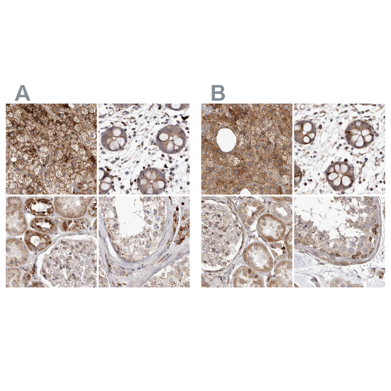 Anti-NUP43 Antibody
