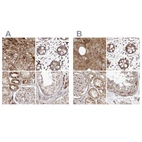 Anti-NUP43 Antibody