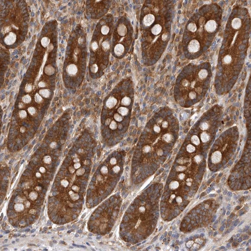Anti-C1orf109 Antibody